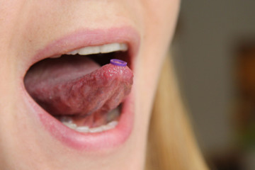Myofunktionelle Schlucktherapie
